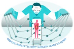 Robotic Prostatectomy Surgery Leads to Sepsis - Tripp Law Firm